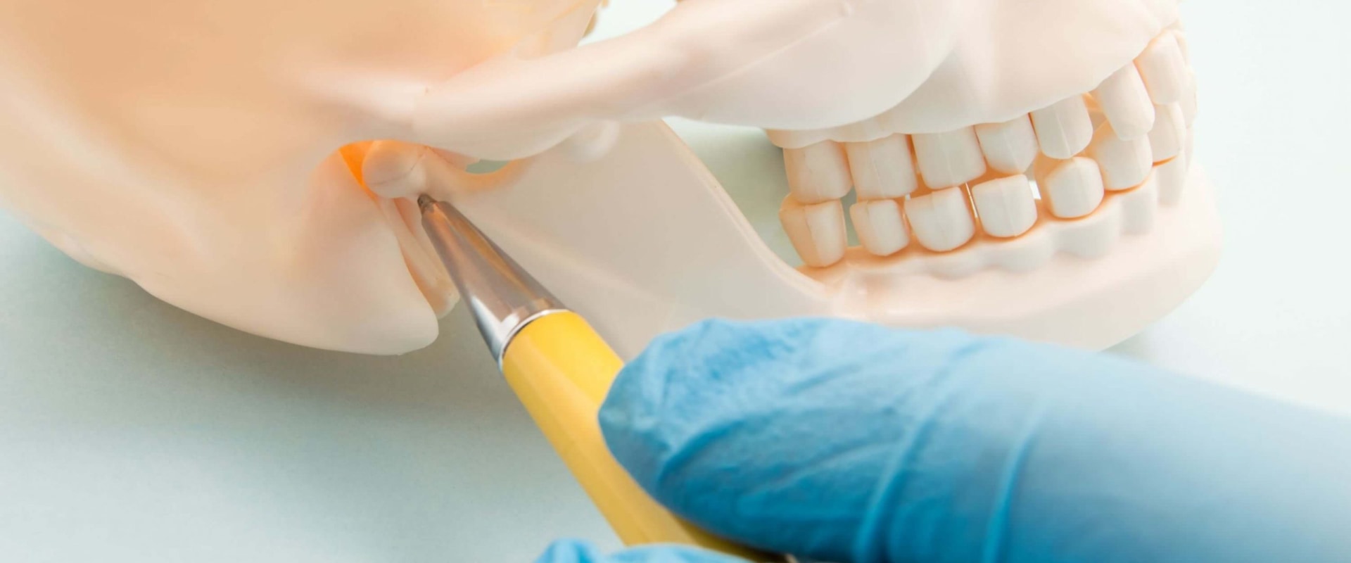 Can I Get TMJ From a Tooth Extraction?