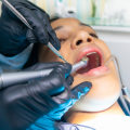 Expertise Matters: How An Experienced Dentist Enhances The Tooth Extraction Process In Pflugerville