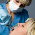 General Dentistry In San Diego: When Tooth Extraction Becomes Necessary