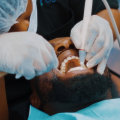 When To Seek An Emergency Dentist In Sterling, VA For Tooth Extraction