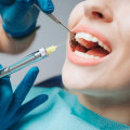 Types of Anesthesia Used for Tooth Extractions