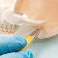 Can I Get TMJ From a Tooth Extraction?