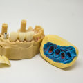 Preparing For Your Tooth Extraction: Tips From Dripping Springs General Dentists