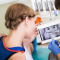 Dental Implants: Restoring Your Smile After Tooth Extraction In McGregor