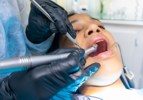 Expertise Matters: How An Experienced Dentist Enhances The Tooth Extraction Process In Pflugerville
