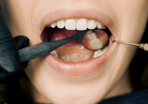 Choosing The Right Dental Clinic For Tooth Extraction In Woden: Here's What To Consider