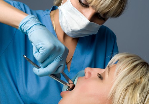 General Dentistry In San Diego: When Tooth Extraction Becomes Necessary