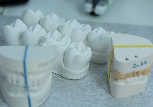 Why Dental Implants Should Be Your Go-To Solution After Tooth Extraction In Austin