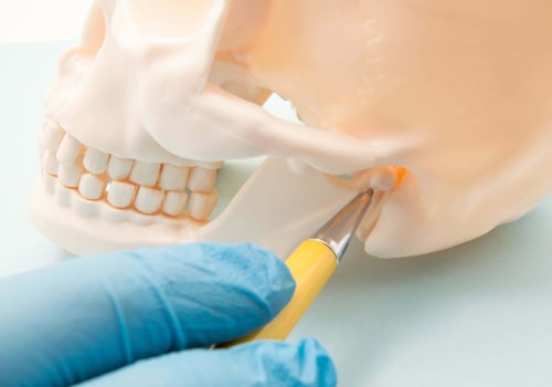 Can I Get TMJ From a Tooth Extraction?