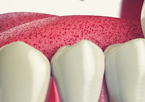 What To Expect During A Tooth Extraction Procedure With An Austin Emergency Dentist